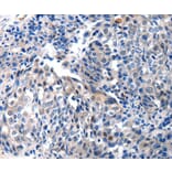 Immunohistochemistry - IGFBP7 Antibody from Signalway Antibody (36930) - Antibodies.com