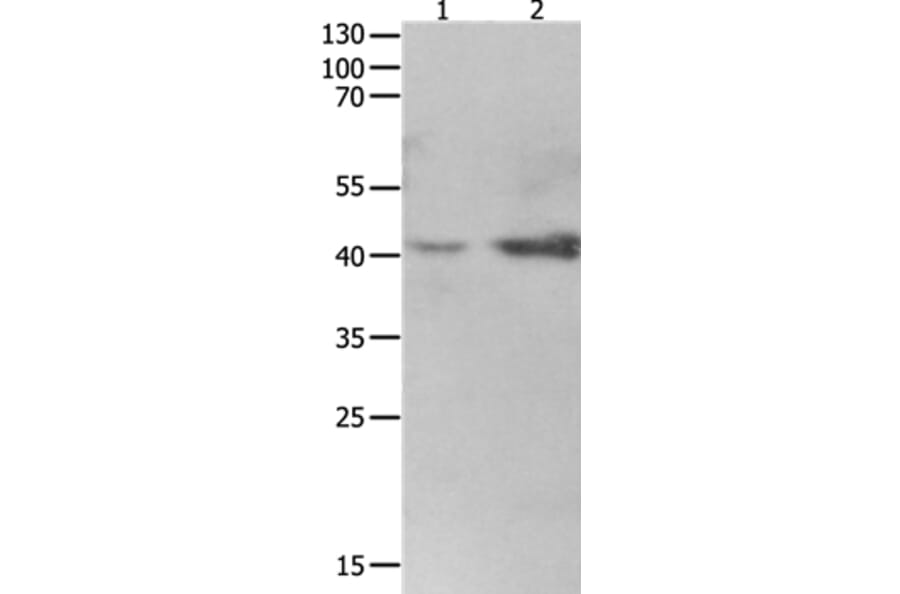 LRPAP1 Antibody from Signalway Antibody (36959) - Antibodies.com