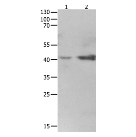 LRPAP1 Antibody from Signalway Antibody (36959) - Antibodies.com
