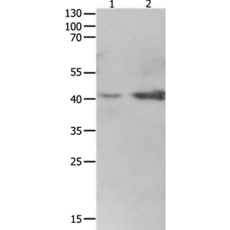 LRPAP1 Antibody from Signalway Antibody (36959) - Antibodies.com
