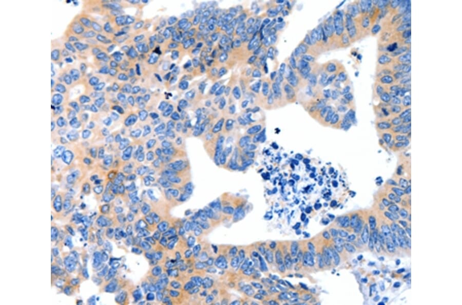 Immunohistochemistry - LRPAP1 Antibody from Signalway Antibody (36959) - Antibodies.com