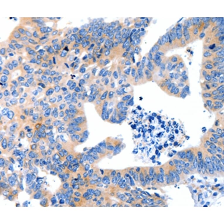 Immunohistochemistry - LRPAP1 Antibody from Signalway Antibody (36959) - Antibodies.com