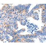 Immunohistochemistry - LRPAP1 Antibody from Signalway Antibody (36959) - Antibodies.com