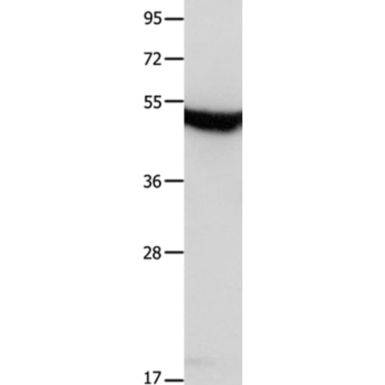 MTNR1A Antibody from Signalway Antibody (36989) - Antibodies.com