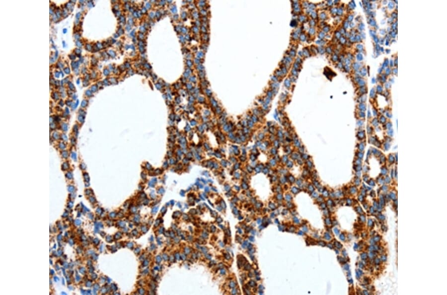 Immunohistochemistry - MTNR1A Antibody from Signalway Antibody (36989) - Antibodies.com