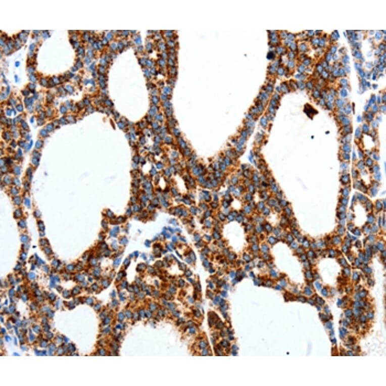 Immunohistochemistry - MTNR1A Antibody from Signalway Antibody (36989) - Antibodies.com