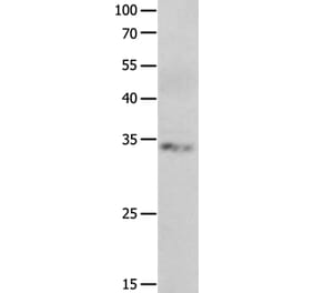 RBFOX3 Antibody from Signalway Antibody (36998) - Antibodies.com