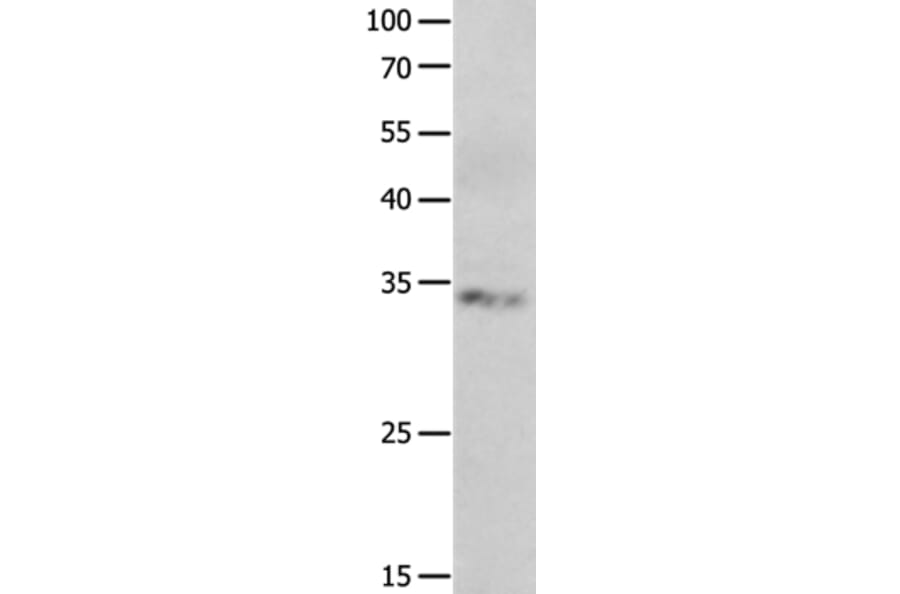 RBFOX3 Antibody from Signalway Antibody (36998) - Antibodies.com