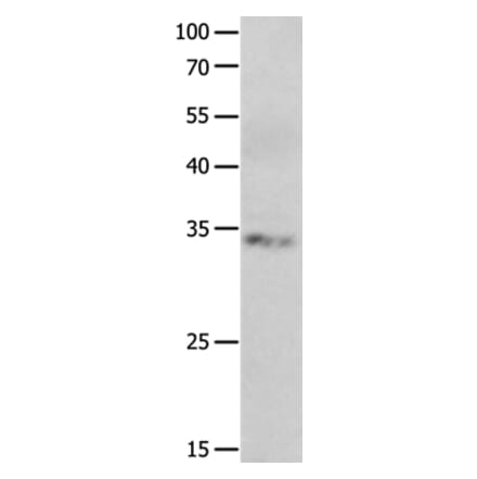 RBFOX3 Antibody from Signalway Antibody (36998) - Antibodies.com