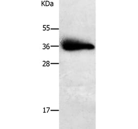 PPAP2A Antibody from Signalway Antibody (37010) - Antibodies.com