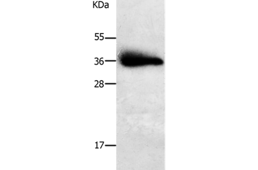 PPAP2A Antibody from Signalway Antibody (37010) - Antibodies.com