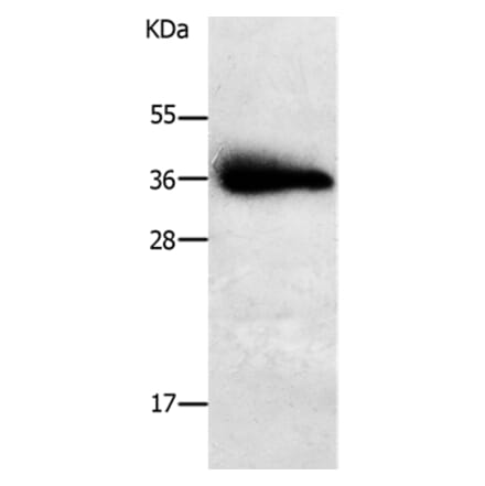 PPAP2A Antibody from Signalway Antibody (37010) - Antibodies.com