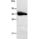 PPAP2A Antibody from Signalway Antibody (37010) - Antibodies.com