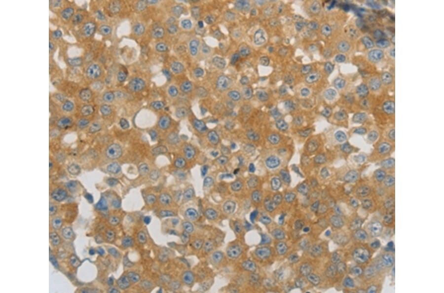 Immunohistochemistry - PPAP2A Antibody from Signalway Antibody (37010) - Antibodies.com