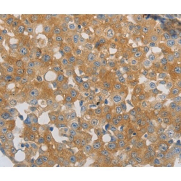 Immunohistochemistry - PPAP2A Antibody from Signalway Antibody (37010) - Antibodies.com