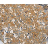 Immunohistochemistry - PPAP2A Antibody from Signalway Antibody (37010) - Antibodies.com