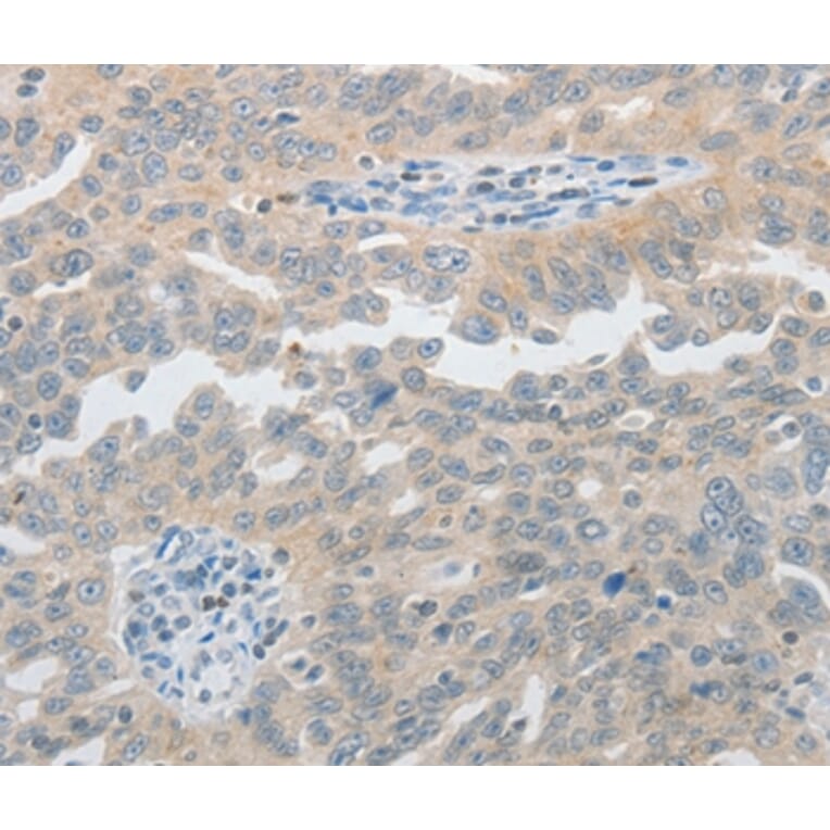 Immunohistochemistry - PIWIL2 Antibody from Signalway Antibody (37017) - Antibodies.com