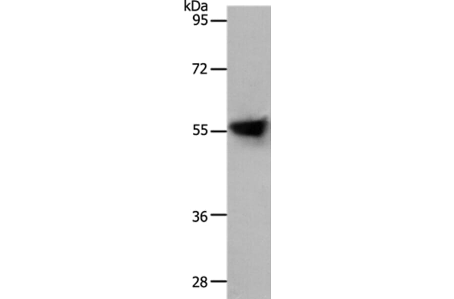 SLC1A4 Antibody from Signalway Antibody (37031) - Antibodies.com