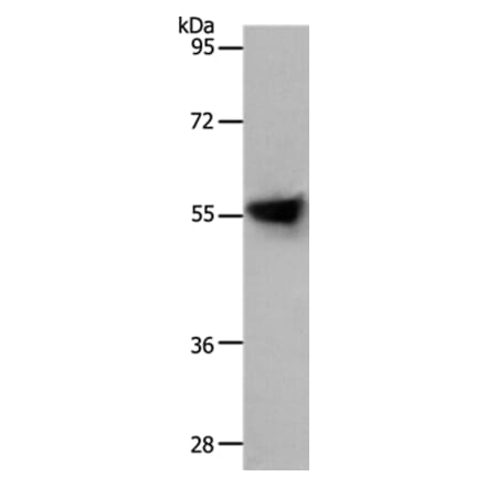 SLC1A4 Antibody from Signalway Antibody (37031) - Antibodies.com