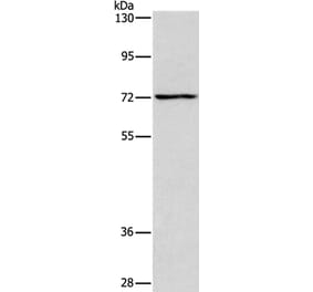 ACADVL Antibody from Signalway Antibody (37078) - Antibodies.com