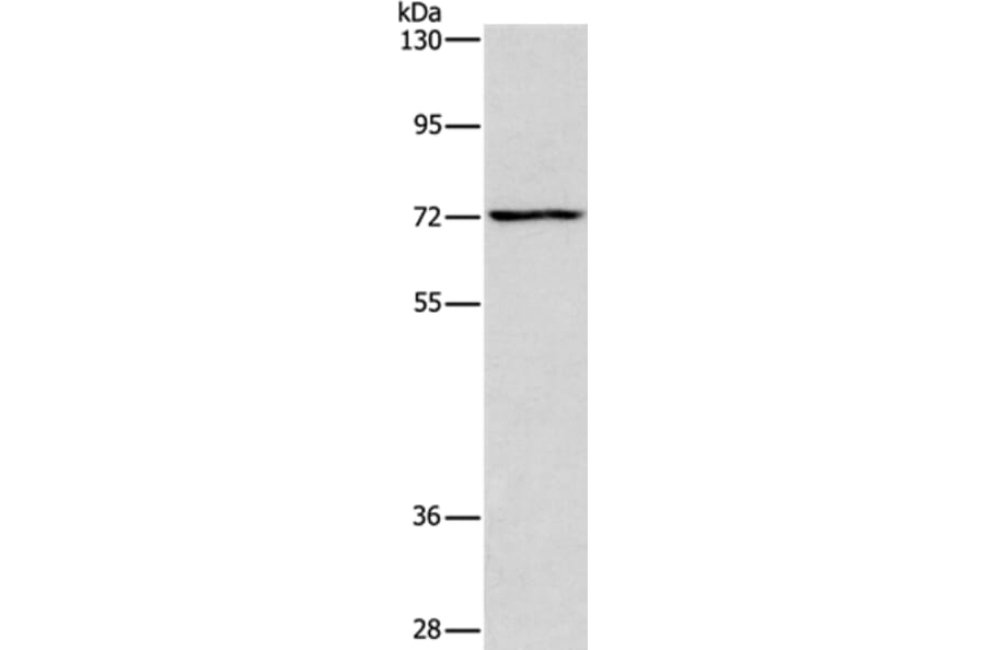 ACADVL Antibody from Signalway Antibody (37078) - Antibodies.com