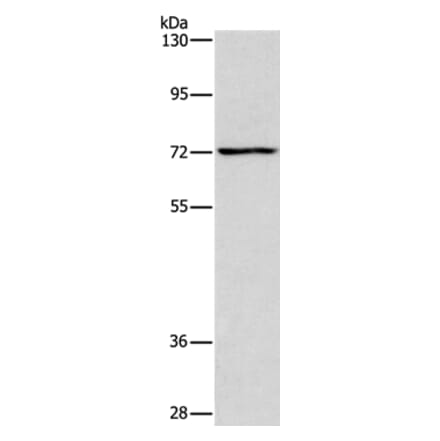 ACADVL Antibody from Signalway Antibody (37078) - Antibodies.com