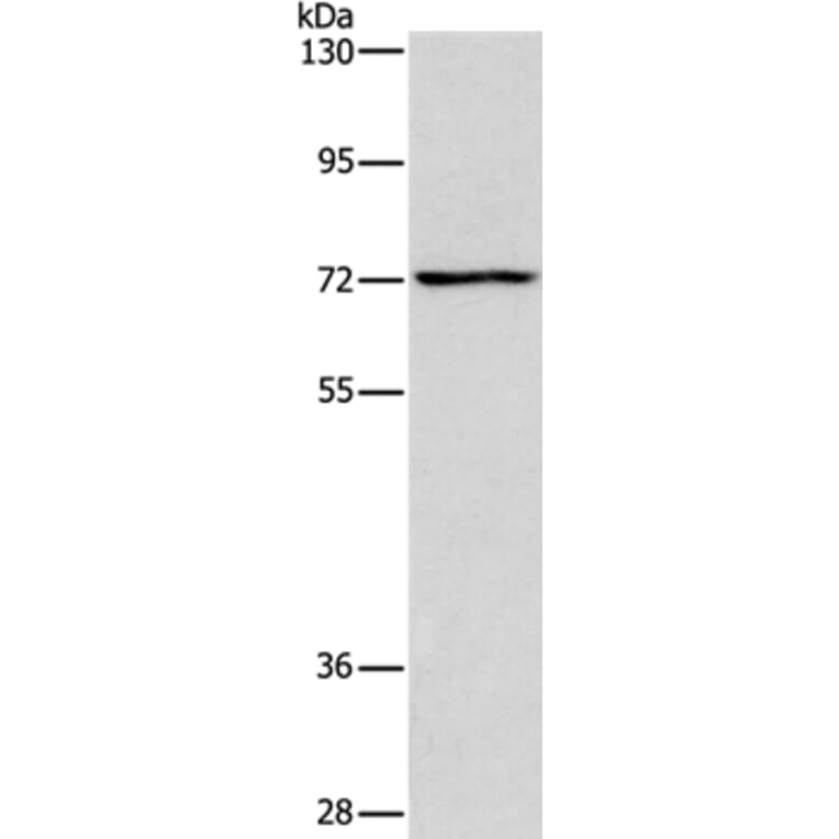 ACADVL Antibody from Signalway Antibody (37078) - Antibodies.com
