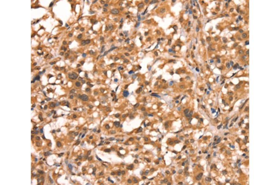 Immunohistochemistry - ACADVL Antibody from Signalway Antibody (37078) - Antibodies.com