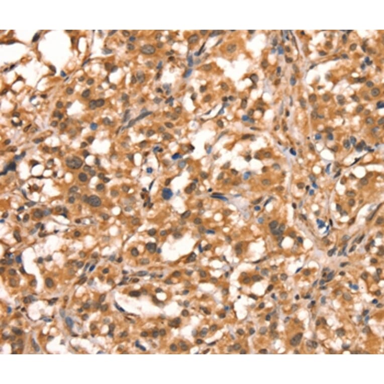 Immunohistochemistry - ACADVL Antibody from Signalway Antibody (37078) - Antibodies.com