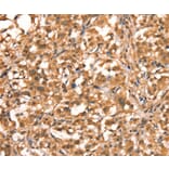 Immunohistochemistry - ACADVL Antibody from Signalway Antibody (37078) - Antibodies.com