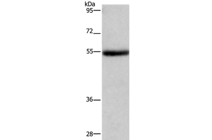 LPCAT4 Antibody from Signalway Antibody (37091) - Antibodies.com