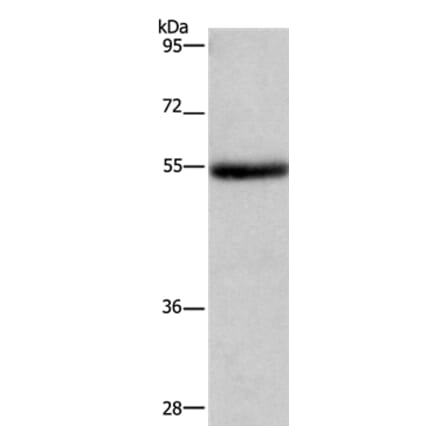 LPCAT4 Antibody from Signalway Antibody (37091) - Antibodies.com