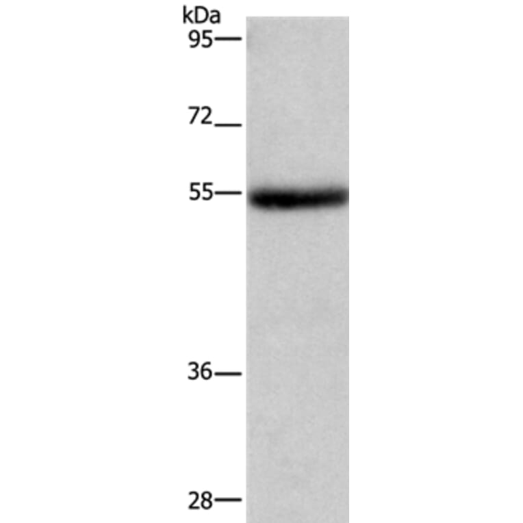 LPCAT4 Antibody from Signalway Antibody (37091) - Antibodies.com