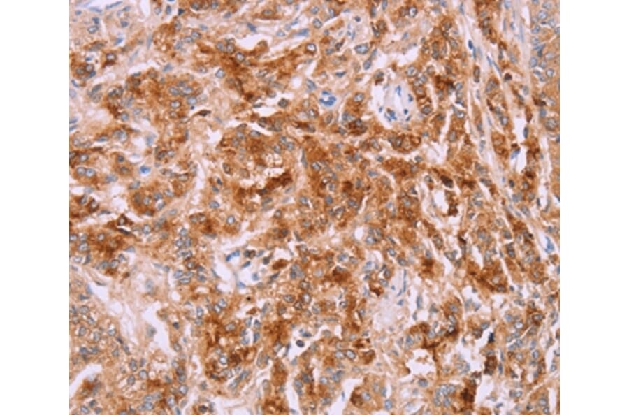 Immunohistochemistry - LPCAT4 Antibody from Signalway Antibody (37091) - Antibodies.com