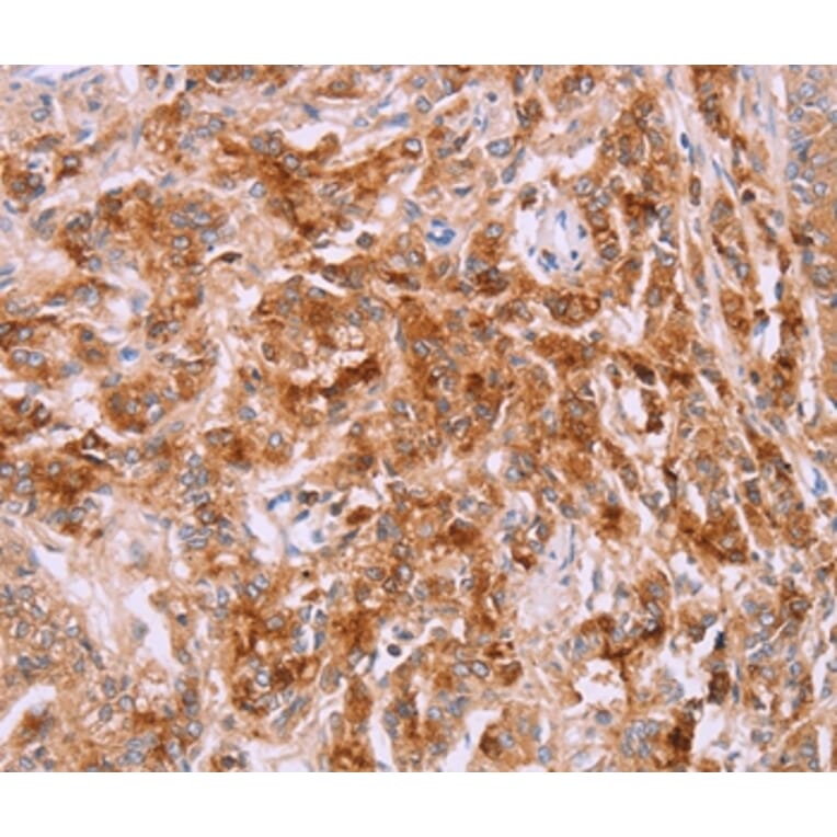 Immunohistochemistry - LPCAT4 Antibody from Signalway Antibody (37091) - Antibodies.com