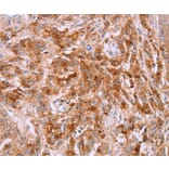 Immunohistochemistry - LPCAT4 Antibody from Signalway Antibody (37091) - Antibodies.com