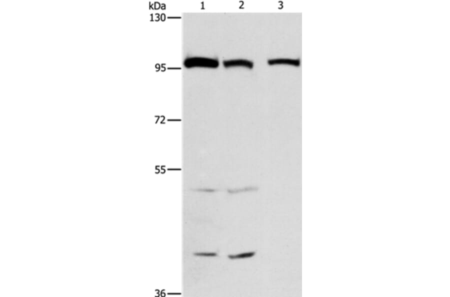 ANAPC4 Antibody from Signalway Antibody (37110) - Antibodies.com
