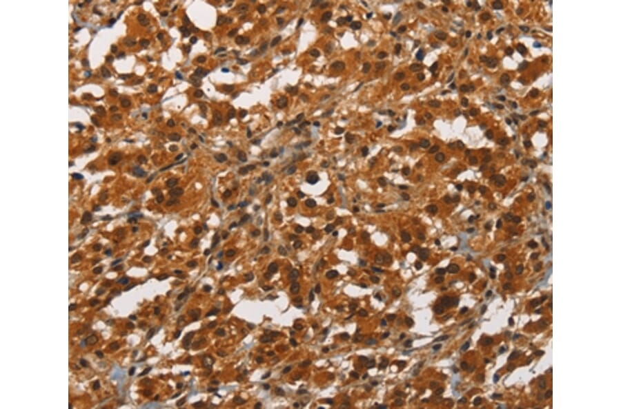 Immunohistochemistry - ANAPC4 Antibody from Signalway Antibody (37110) - Antibodies.com