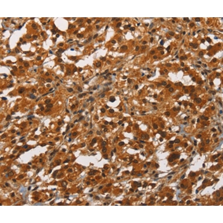 Immunohistochemistry - ANAPC4 Antibody from Signalway Antibody (37110) - Antibodies.com