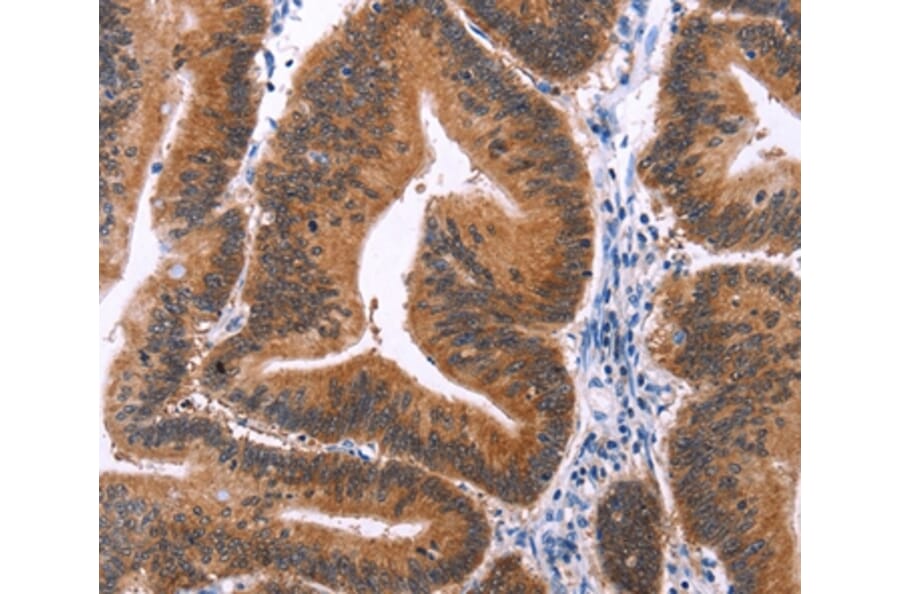 Immunohistochemistry - MAPK13 Antibody from Signalway Antibody (37132) - Antibodies.com