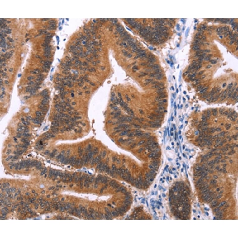 Immunohistochemistry - MAPK13 Antibody from Signalway Antibody (37132) - Antibodies.com