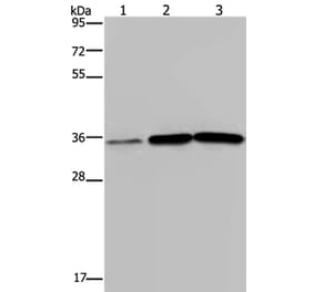 MAGEA3 Antibody from Signalway Antibody (37138) - Antibodies.com