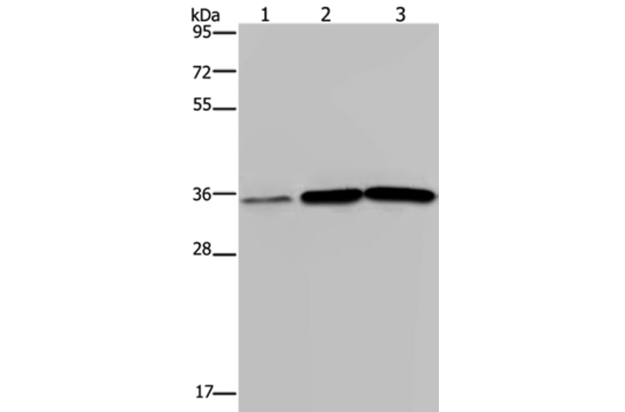 MAGEA3 Antibody from Signalway Antibody (37138) - Antibodies.com