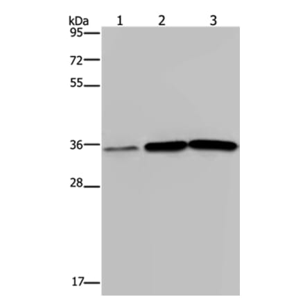 MAGEA3 Antibody from Signalway Antibody (37138) - Antibodies.com