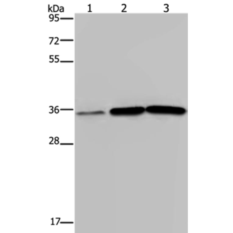 MAGEA3 Antibody from Signalway Antibody (37138) - Antibodies.com