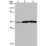 MAGEA3 Antibody from Signalway Antibody (37138) - Antibodies.com