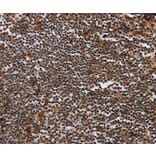 Immunohistochemistry - MAGEA3 Antibody from Signalway Antibody (37138) - Antibodies.com