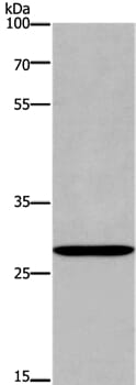 Gel: 8% SDS-PAGE Lysate: 40ug Raji cell Primary antibody: 1/400 dilution Secondary antibody dilution: 1/8000 Exposure time: 20 seconds