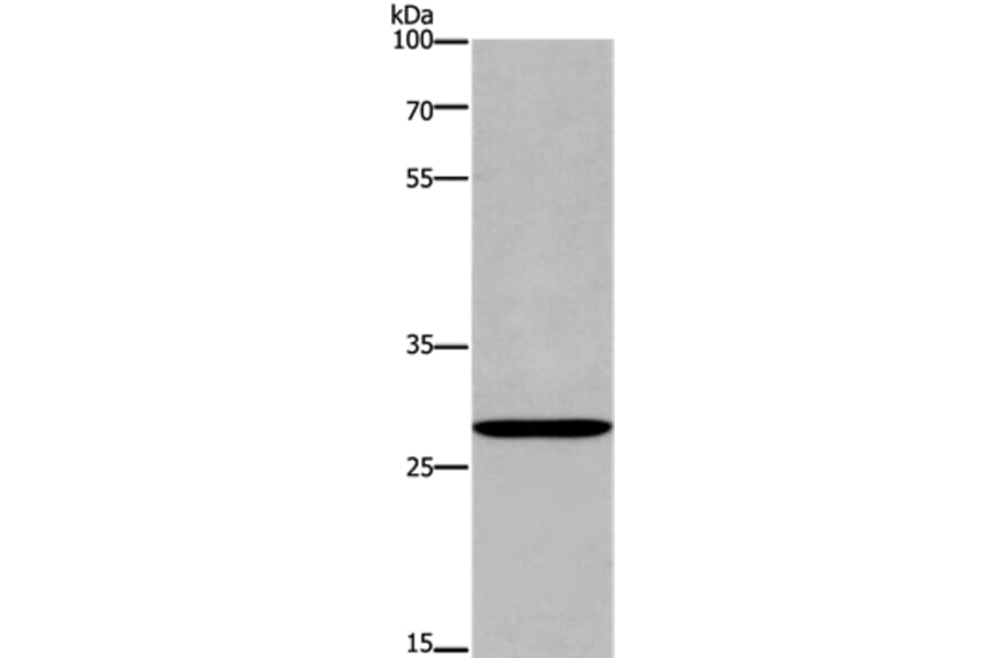 ANP32C Antibody from Signalway Antibody (37145) - Antibodies.com
