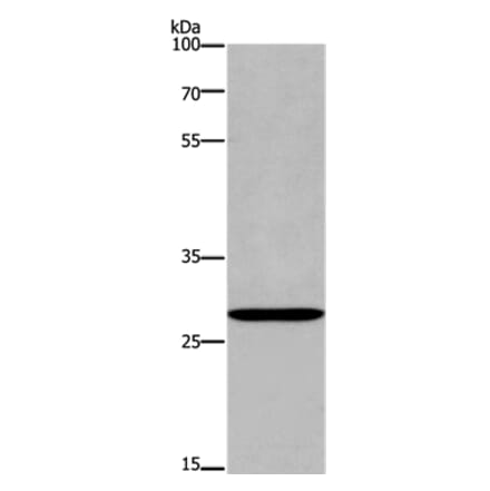 ANP32C Antibody from Signalway Antibody (37145) - Antibodies.com